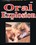 Oral Explosion Vorschau